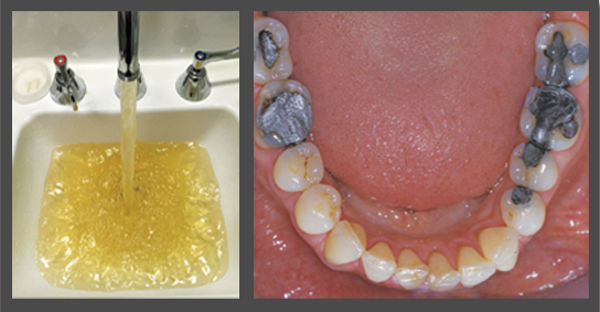 Dose levels are multiplied when both lead and mercury are present.